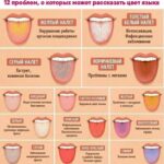 Состояние языка: норма и отклонения, диагностика