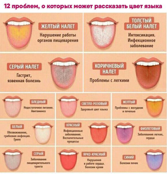 Состояние языка: норма и отклонения, диагностика