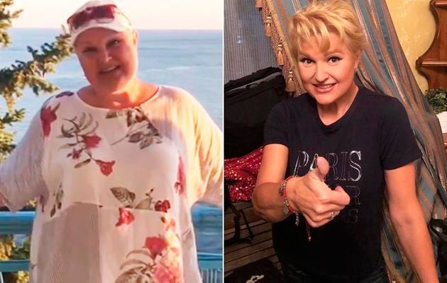 Похудение после шунтирования желудка и без операций