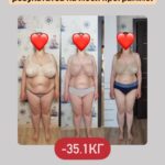 Снижение веса и красота: Результаты и сопровождение
