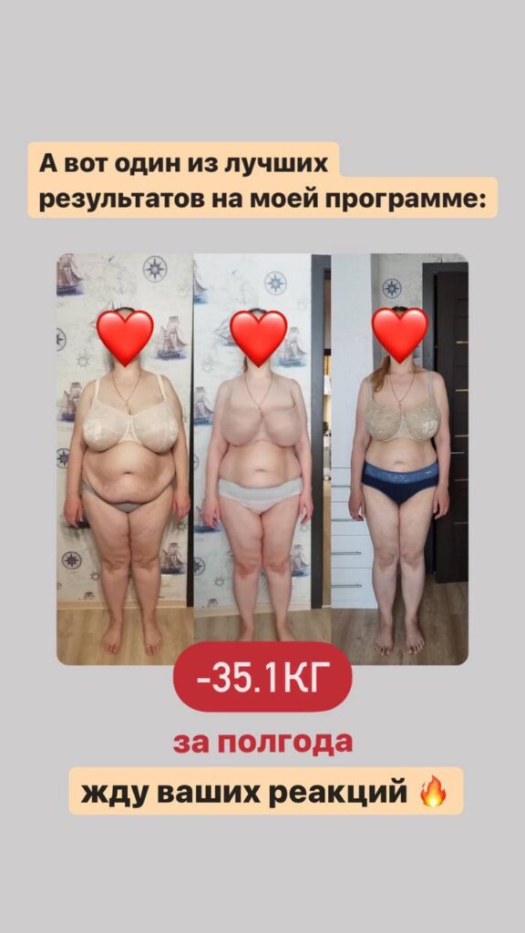 Снижение веса и красота: Результаты и сопровождение