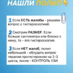 Полипы и риск злокачественности: причины и диагностика