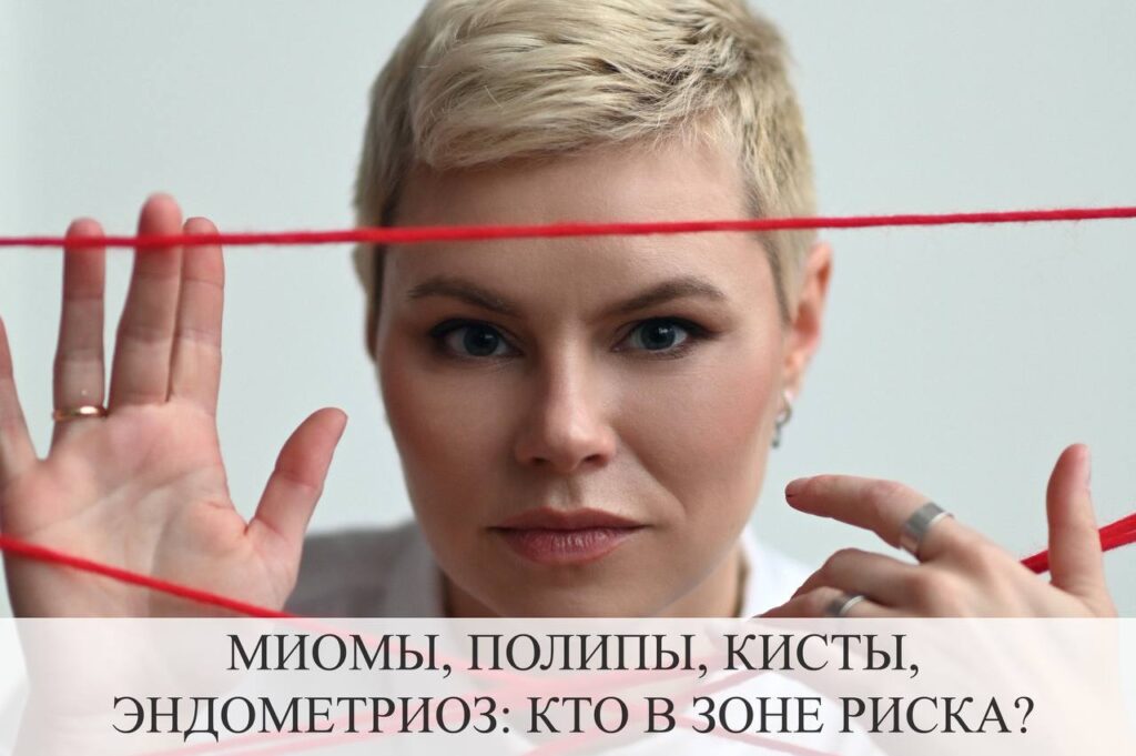 Миомы, полипы, кисты, эндометриоз: кто в зоне риска?