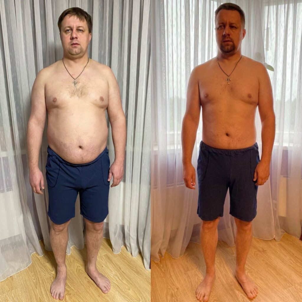 Трансформация тела и лица: Истории успеха и новые возможности