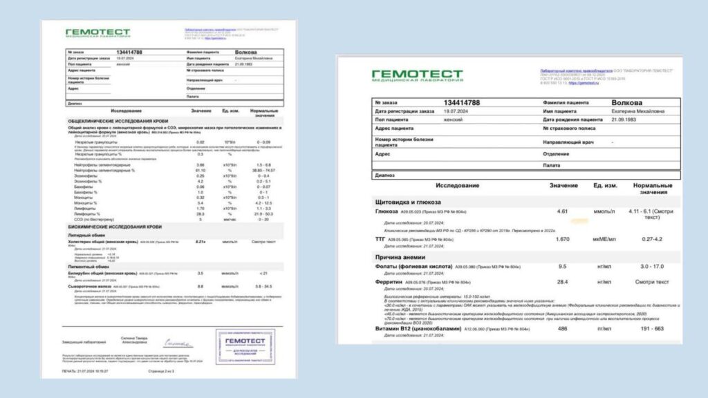 Уход за волосами: от блонда до роста и проблемы дефицита железа