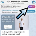 Прямой эфир: Миомы, кисты, эндометриоз – разбор ваших ситуаций