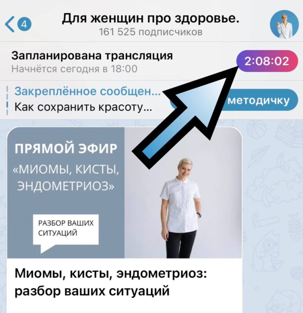 Прямой эфир: Миомы, кисты, эндометриоз – разбор ваших ситуаций