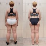 Эффект «блюр» на фото: как похудение меняет кожу