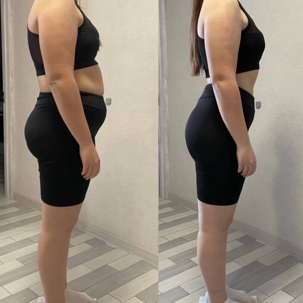 Как выбрать срок сопровождения для похудения