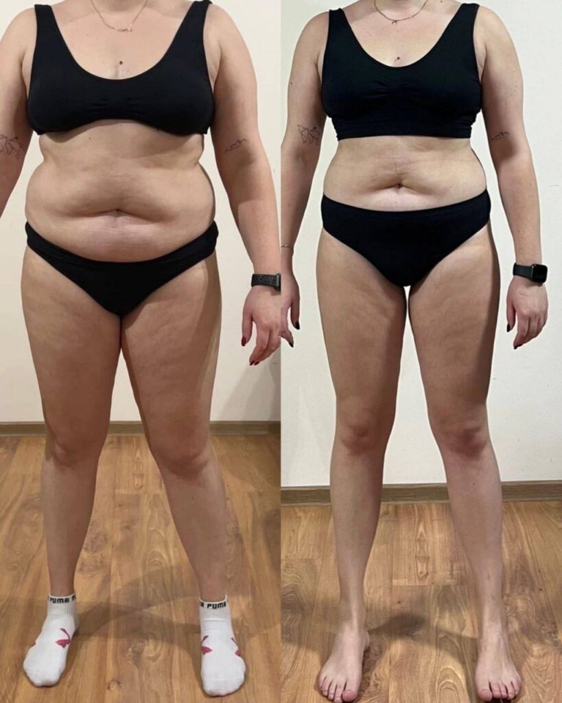 Аня Орехова: Диетолог и Гинеколог для Вашей Красоты и Здоровья