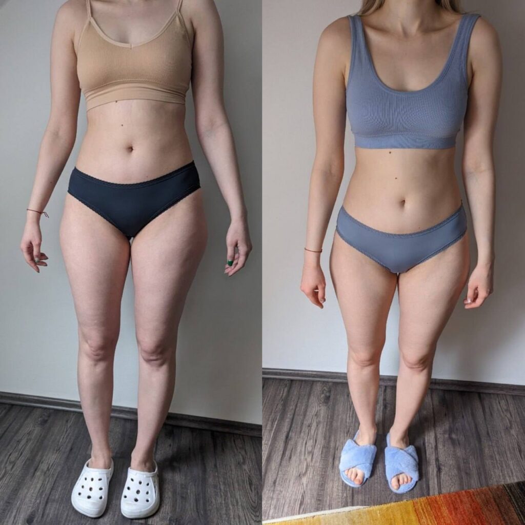 Как похудеть за месяц и обрести здоровую жизнь: История успеха и советы от доктора