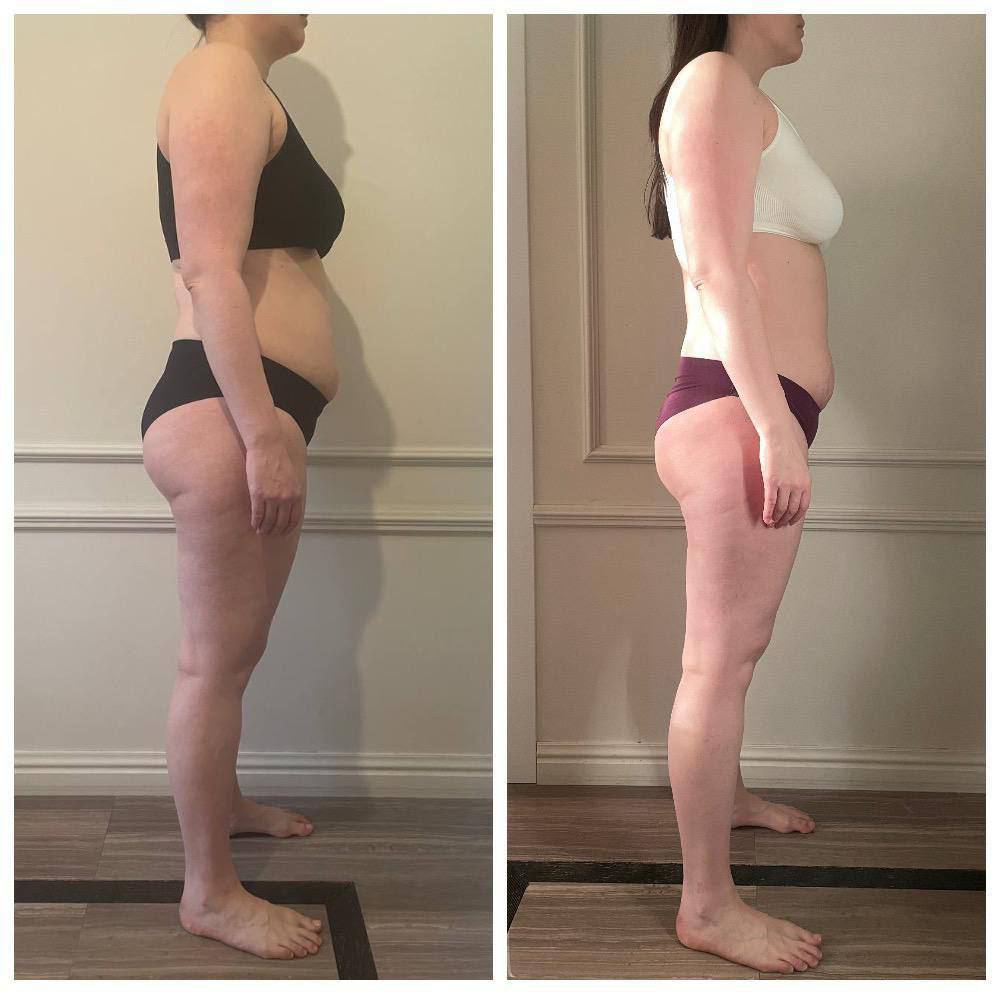 Минус 3 кг за 60 дней: История преображения с доктором Комиссаровой!